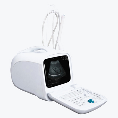 U630 Portable Ultrasound